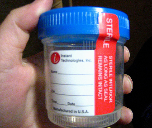 Urine Drug Testing Drug Testing Center of Connecticut